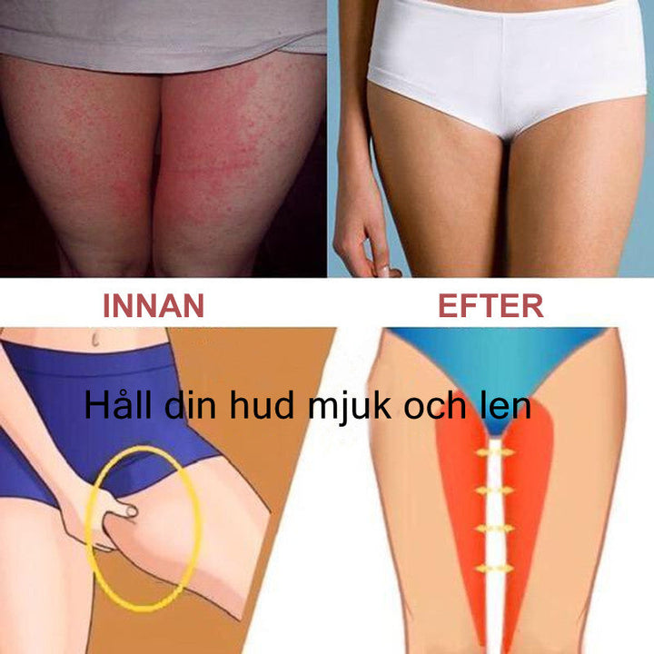 Dam mjuka vida bomullsshorts, hög midja, säkra komforten och unika fickor, lämplig för sommar och dagsaktiviteter.