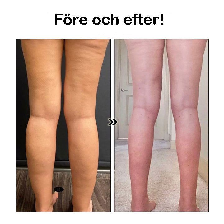 Magnetiska Örhängen För Viktminskning