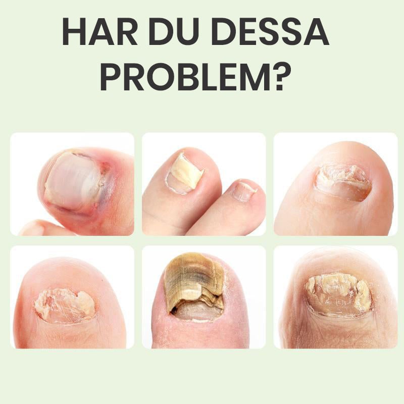 "Flaska med magiska nagelreparation droppar för starka, hälsosamma naglar, djupverkande skönhetsprodukt."