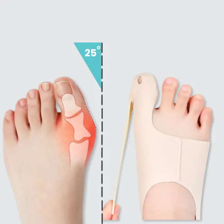 Halluxkorrigerande tåhylsa för lindring av hallux valgus. Ger daglig fotkomfort och diskret tåstöd.