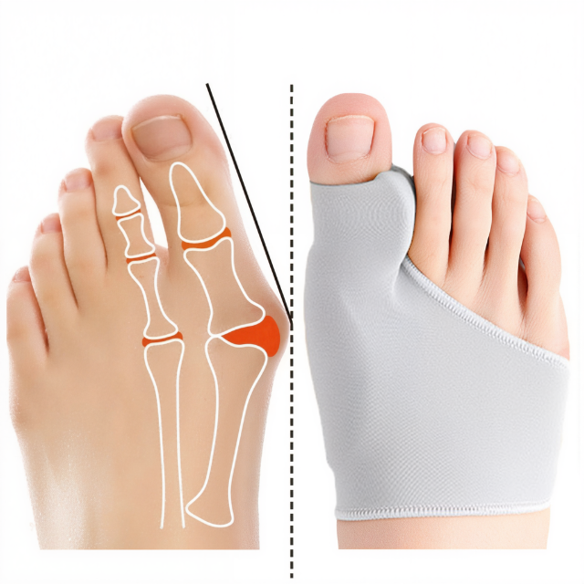 Ortopedisk tåseparator med gelkudde. Unisex fotskydd för hallux valgus, smärtlindring & fotkomfort.