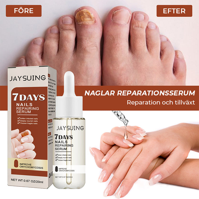 "Serumflaska för nageltillväxt på vit bakgrund, snabb effekt 7 dagar, för starkare och längre naglar i 20ml förpackning."