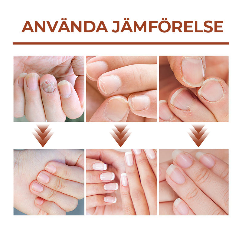 "Serumflaska för nageltillväxt på vit bakgrund, snabb effekt 7 dagar, för starkare och längre naglar i 20ml förpackning."