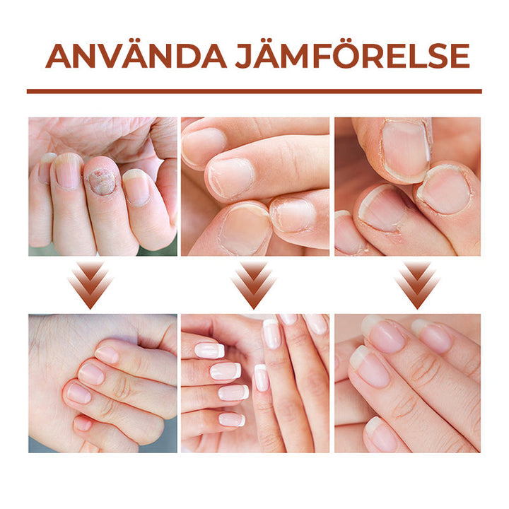 "Serumflaska för nageltillväxt på vit bakgrund, snabb effekt 7 dagar, för starkare och längre naglar i 20ml förpackning."