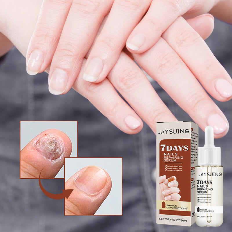 "Serumflaska för nageltillväxt på vit bakgrund, snabb effekt 7 dagar, för starkare och längre naglar i 20ml förpackning."
