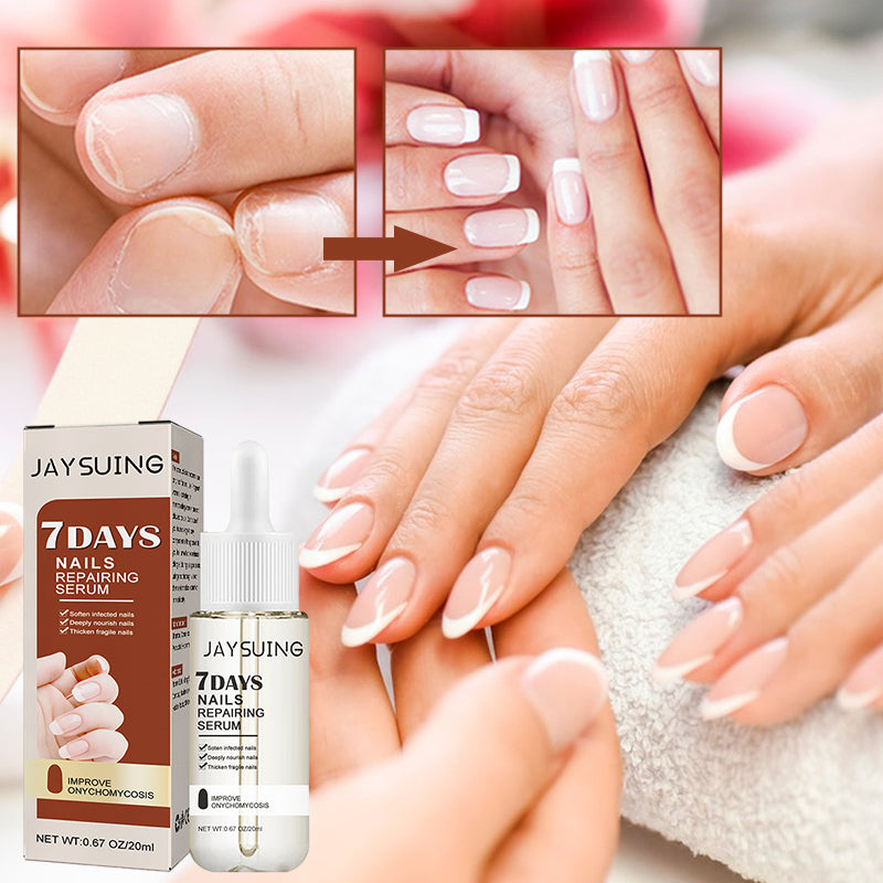 "Serumflaska för nageltillväxt på vit bakgrund, snabb effekt 7 dagar, för starkare och längre naglar i 20ml förpackning."