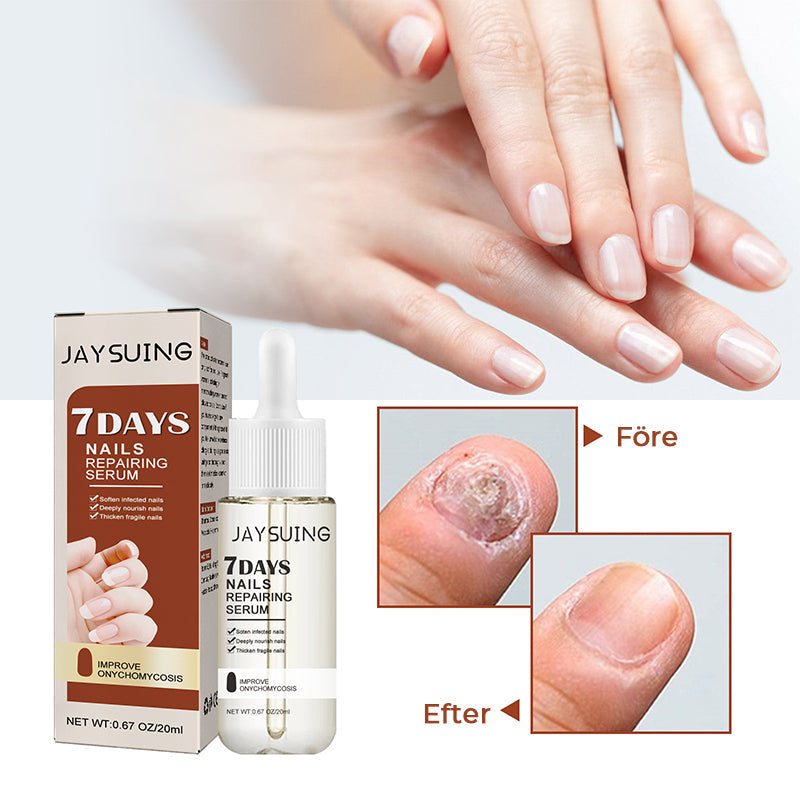 "Serumflaska för nageltillväxt på vit bakgrund, snabb effekt 7 dagar, för starkare och längre naglar i 20ml förpackning."