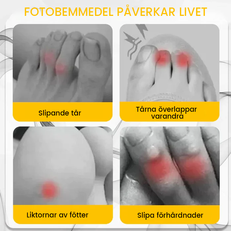 "Silikon tåskydd i genomskinligt material för personlig komfort och smärtlindring, idealiska för liktornar och blåsor."