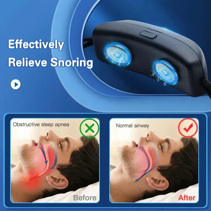 Effektiv anti-snarkningsenhet för sömnapné, förbättrar andning och allmän hälsa.