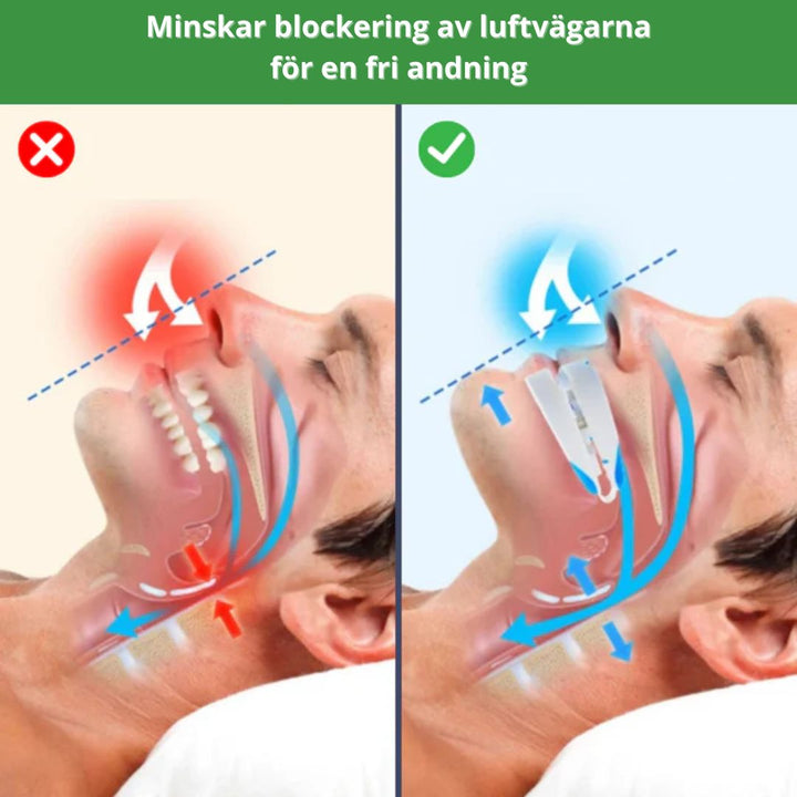 Munskena för bättre sömn. Reducerar snarkning och bidrar till ökad sömnkvalitet och generell hälsa.