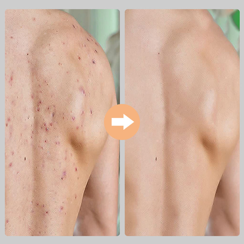 "Unisex exfolieringshandskar i viskos, böngrön och lila färg, tar bort död hud för mjukare hud."