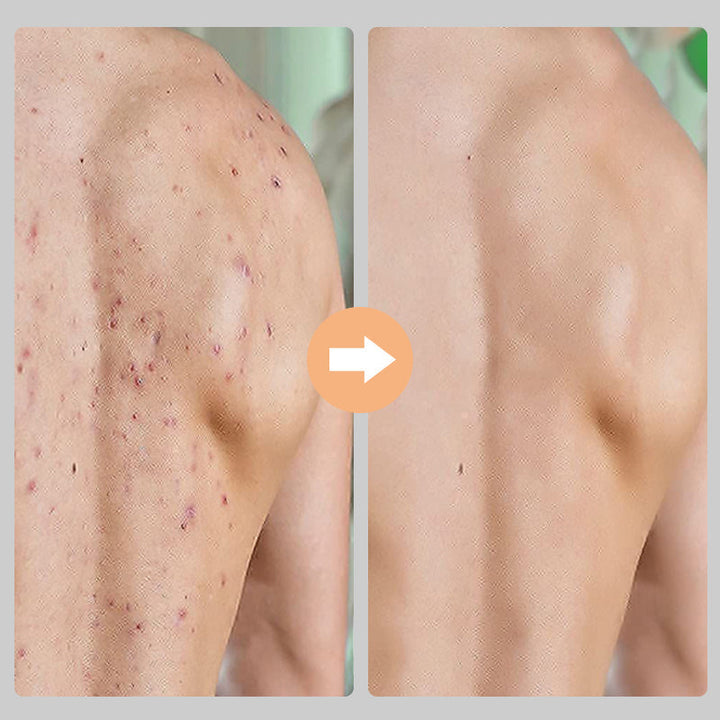 "Unisex exfolieringshandskar i viskos, böngrön och lila färg, tar bort död hud för mjukare hud."