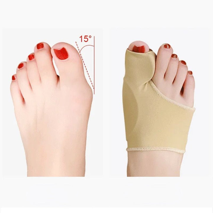 Unisex Valgus-tåskydd med silikonkuddar, beige färg, fotvårdsskydd för smärtlindring och förbättrad gångställning.