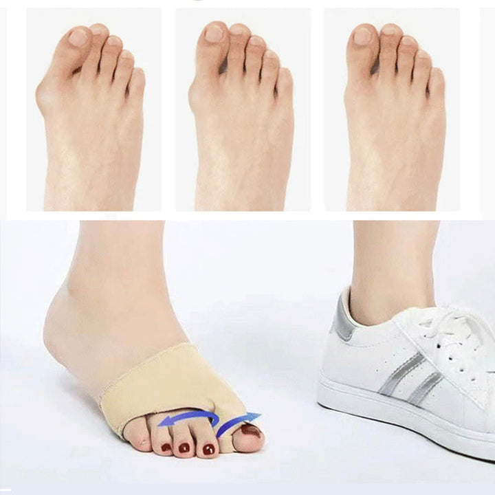 Unisex Valgus-tåskydd med silikonkuddar, beige färg, fotvårdsskydd för smärtlindring och förbättrad gångställning.