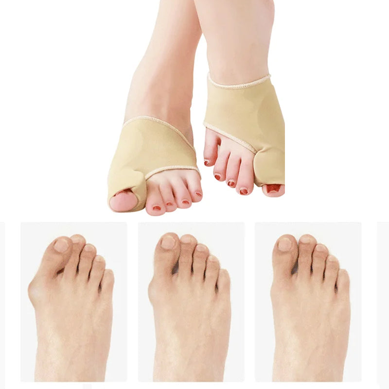 Unisex Valgus-tåskydd med silikonkuddar, beige färg, fotvårdsskydd för smärtlindring och förbättrad gångställning.