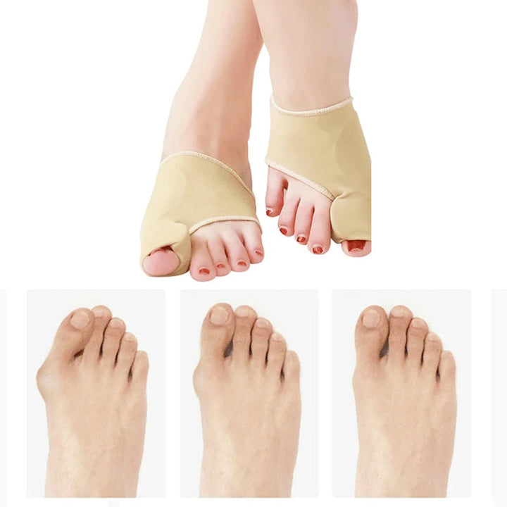 Unisex Valgus-tåskydd med silikonkuddar, beige färg, fotvårdsskydd för smärtlindring och förbättrad gångställning.